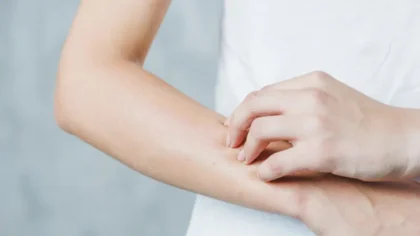 050210400 1606124838 close up woman s hand scratching her hand 23 2147948422 1